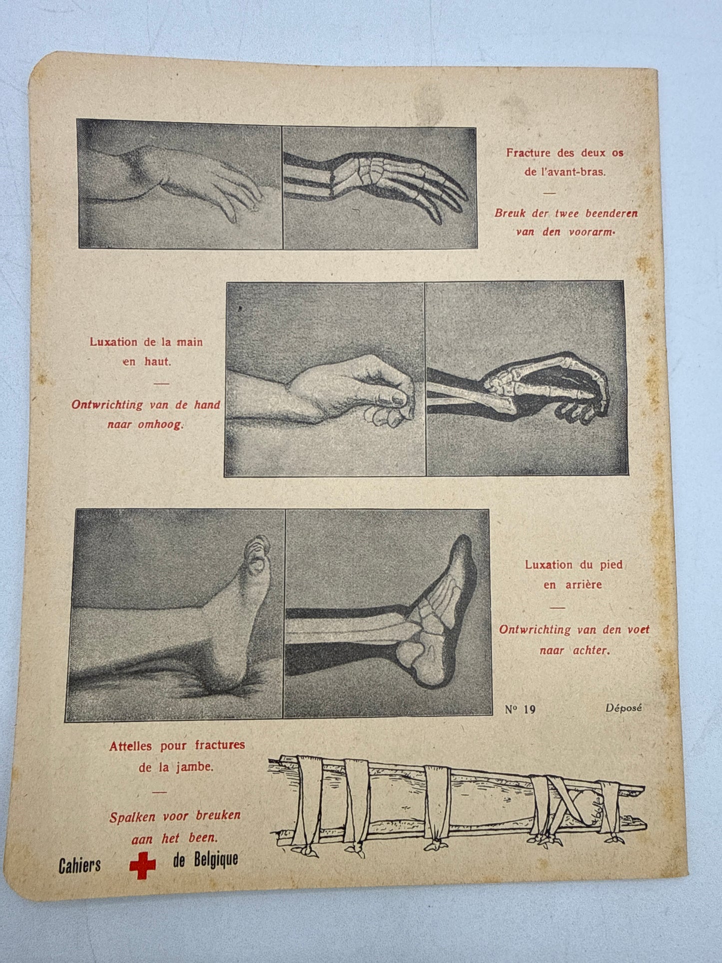 An educational diagram of a hand and arm with labeled parts on a beige background.